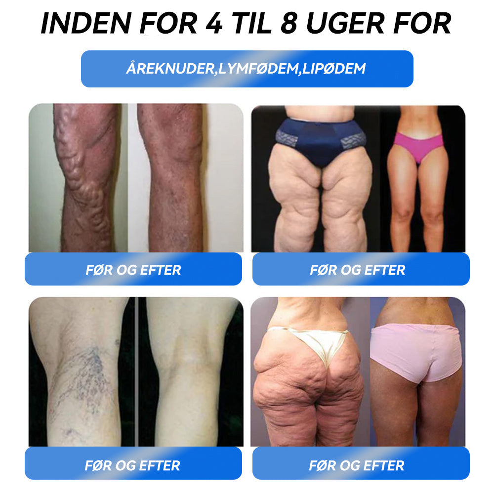 IFMAGIC® GLP-1 Pro Vægttab Oral Opløsning👩⚕️En dosis om dagen – synlige resultater inden for 7 dage🔥Velegnet til kroniske sygdomme, fedme, diabetes, hjerte-kar-sygdomme🪷