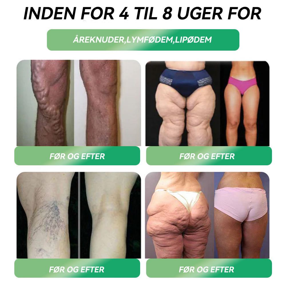 STDEI® GLP-1 Vægttabs Oral Opløsning 🔥Bare én dosis om dagen – allerede efter 7 dage kan du se tydelig effekt 👩⚕️ Virker mod overvægt, hjerte-kar-sygdomme, diabetes, søvnapnø, ledproblemer og mere🌻