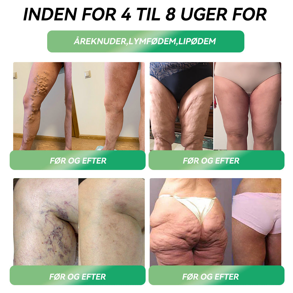 🎁Tillykke! Du er en af vores heldige vindere! 💪 Som vores eksklusive lykkestjerne får du nu en fantastisk rabat på 30%! Gå ikke glip af denne unikke mulighed for at forkæle dig selv med noget helt særligt! 🛍️💫