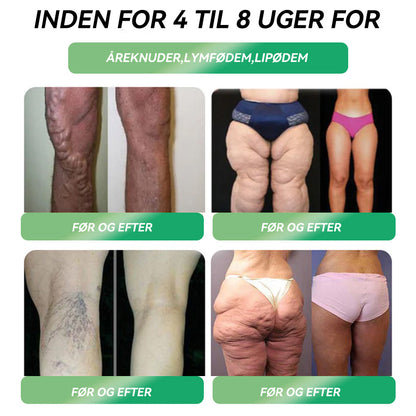 STDEI® GLP-1 Vægttabs Oral Opløsning 🌸 Bare én dosis om dagen – allerede efter 7 dage kan du se tydelig effekt ✅ Virker mod overvægt, hjerte-kar-sygdomme, diabetes, søvnapnø, ledproblemer og mere🔥