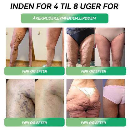 🎁Tillykke! Du er en af vores heldige vindere! 💪 Som vores eksklusive lykkestjerne får du nu en fantastisk rabat på 30%! Gå ikke glip af denne unikke mulighed for at forkæle dig selv med noget helt særligt! 🛍️💫
